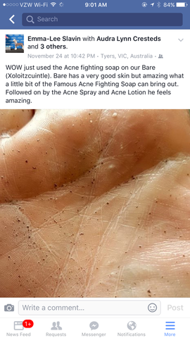 Famous Acne Fighting Soap - Famous Skin Care